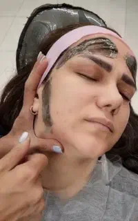 وکس،درماپلینگ،پاکسازی،کاشت مژه