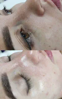 فیشال تخصصی پوست و مو