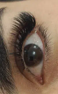 کاشت مژه