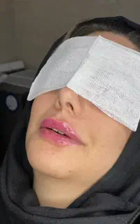 تخفیف خدمات زیبایی ،بوتاکس ،فیلرلب
