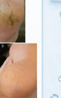 کرم جوانی پا