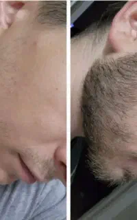 آخرین شانسه ریشاته