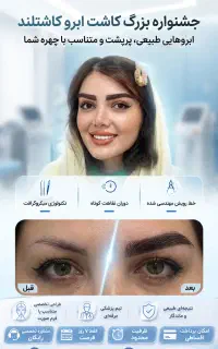 کاشت مو و ابرو کاشتلند