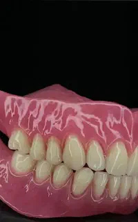 دندانسازی ساخت تخصصی دندان مصنوعی در یزد