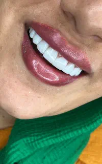 تخفیف عید قربان کامپوزیت ونیر واحدی ۱.۹۰۰