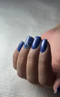 کاشت و ترمیم ناخن