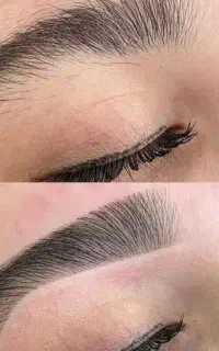 اصلاح تخصصی ابرو