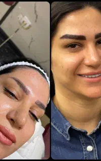 تیم تخصصی کاشت مو و ابرو و ریش میکروکاشت