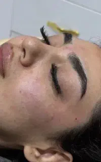 ژل هر سی سی ۱۵۰۰، آنزیم۹۵۰، بوتاکس۹۵۰