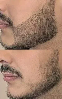 ریشاتو جنگل امازون کن
