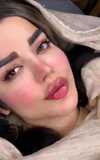 پی آرپی prp بایوفیلر اگزوزوم ژل فیلر بوتاکس آنزیم