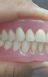 دست دندون پروتز متحرک بتا استار