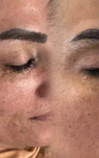 تراپی دورچشم آف ویژه برای اقا و خانم فقط ۷۹۰ تومان