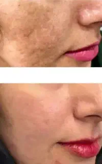 محصولات کرش پسند کرم سفید کننده