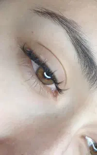 کاشت مژه