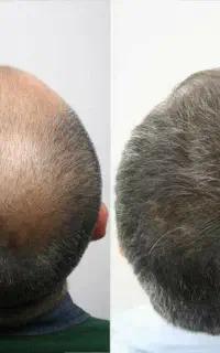 نزن رو آگهی