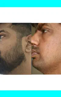 ریشه که کمبودش حس نمیشه