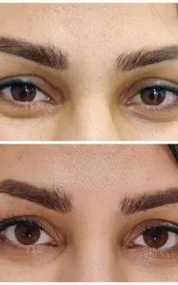 زیبایی به سبک علمی و نچرال توسط پزشک