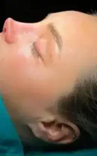 عمل بینی بلفاروپلاسی لیفت صورت سانترال تزریق چربی