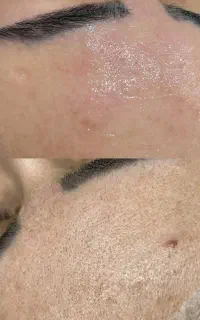 (فیشال تخصصی پوست)