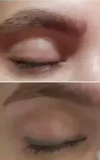 پاک کردن تتو قدیمی و خدمات زیبایی
