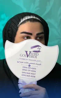 کاشت تخصصی ابرو و مو