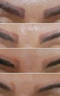 ریموو ابرو ، چشم ، لب تخصصی