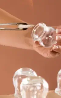 حجامت بهاری توسط متخصص طب سنتی