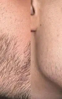 مرد بدون ریش صددرصد کنسله