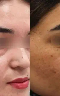 بیوممتیک اورجینال(سفیدی تضمینی)