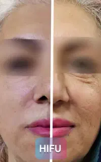 کلینیک زیبایی شبانه روزی مهتا با بهترین پزشکان