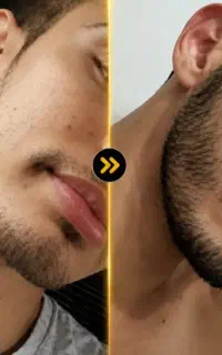 با نازکی ریش.موهات خداحافظی کن