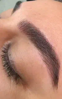 اصلاح صورت رایگان به مدت دو روز ظرفیت محدود