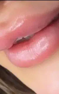 آفرژل وچربی