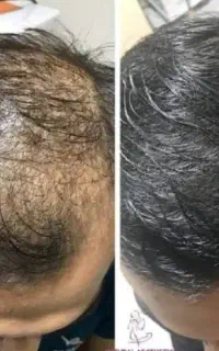 سر از تو رویش دوباره موهات از من