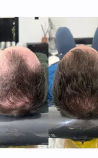 شروع فصل جدیدی از زیبایی
