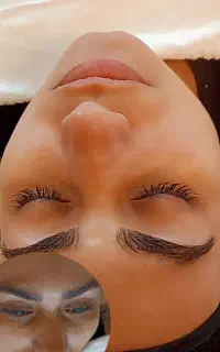 فیشال و پاکسازی پوست