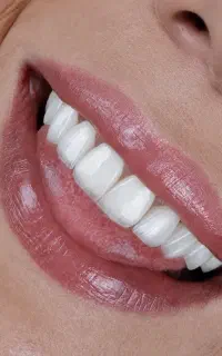 جشنواره دندانپزشکی‌مطب دکتر شادمان پردیس
