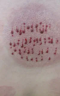 اعمال یداوی