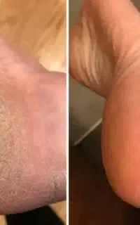 پدیکور و پارافین با ۱۰ سال سابقه