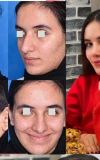 عمل بینی مشهد ویژه مراجعین تربت حیدریه