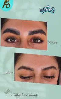 پاک کردن تتو خالکوبی،ریموو تتو ابروـ بدن مایابیوتی