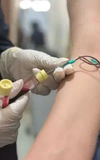 پی ارپی ژل و بوتاکس