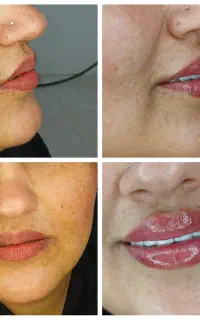 تخفیف باورنکردنی ویژه زیبایی خدمات خانوم و آقا