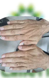 بررسی تخصصی وضعیت سلامت از طریق چهره، زبان و دست