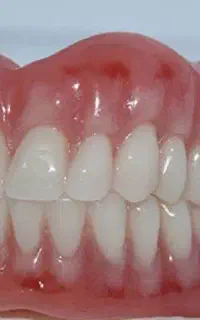 طرح ویژه دندانسازی