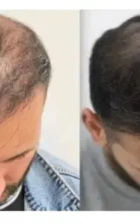 این اقدام آخریشه