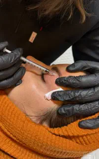 فیلر، بوتاکس، مزوتراپی و خدمات پوست و مو توسط پزشک