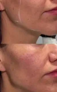 جشنواره تابستانی مرکز زیبایی و مراقبت پوستی سپیدار