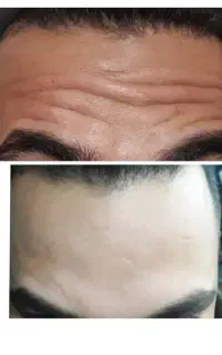 خدمات بوتاکس فیلر پاکسازی پوست
